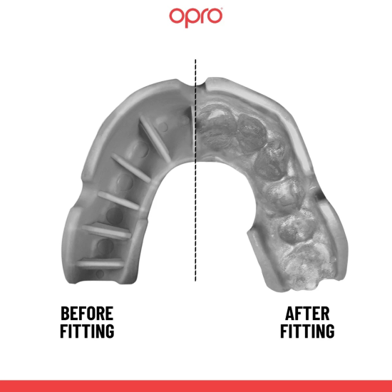 Protector bucal Opro Silver transparente adulto